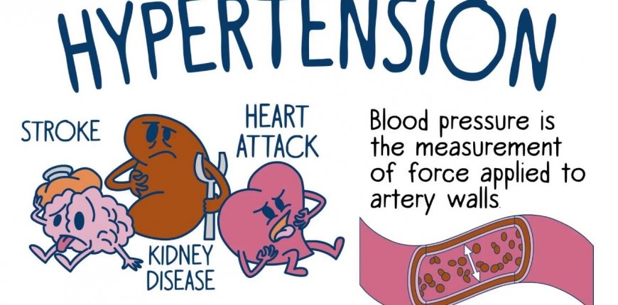 Hypertension – Family Risk and What You Should Know